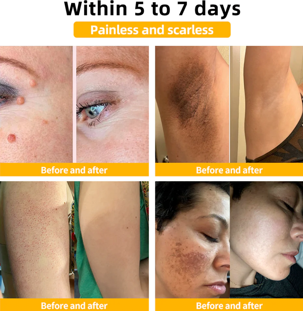 HOUKEA - Bee Venom Skin Care Cream