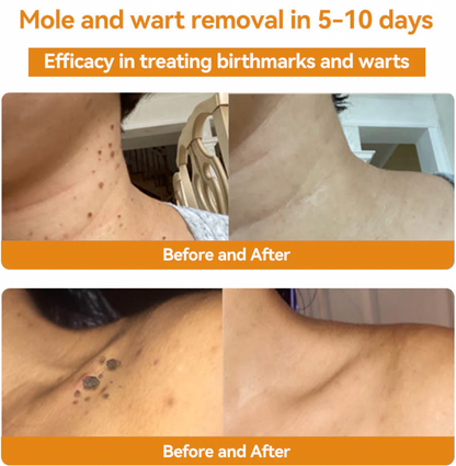 HOUKEA - Bee Venom Skin Care Cream